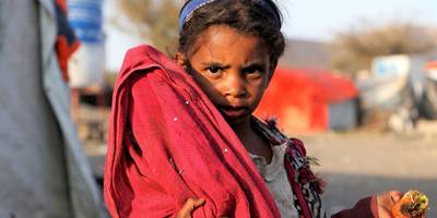 Åbn link til  Hver dag såres børn i Yemens borgerkrig